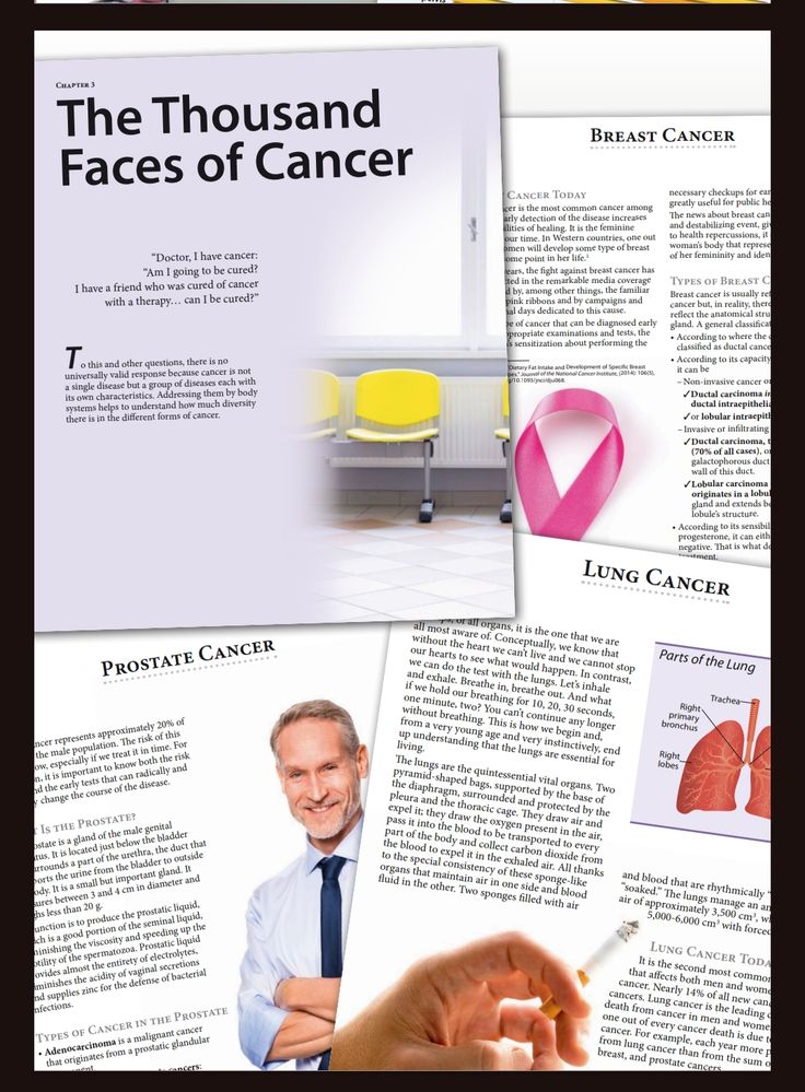 Cancer: Practical Guide to Understanding, Preventing and Coping with the Disease - Image 4
